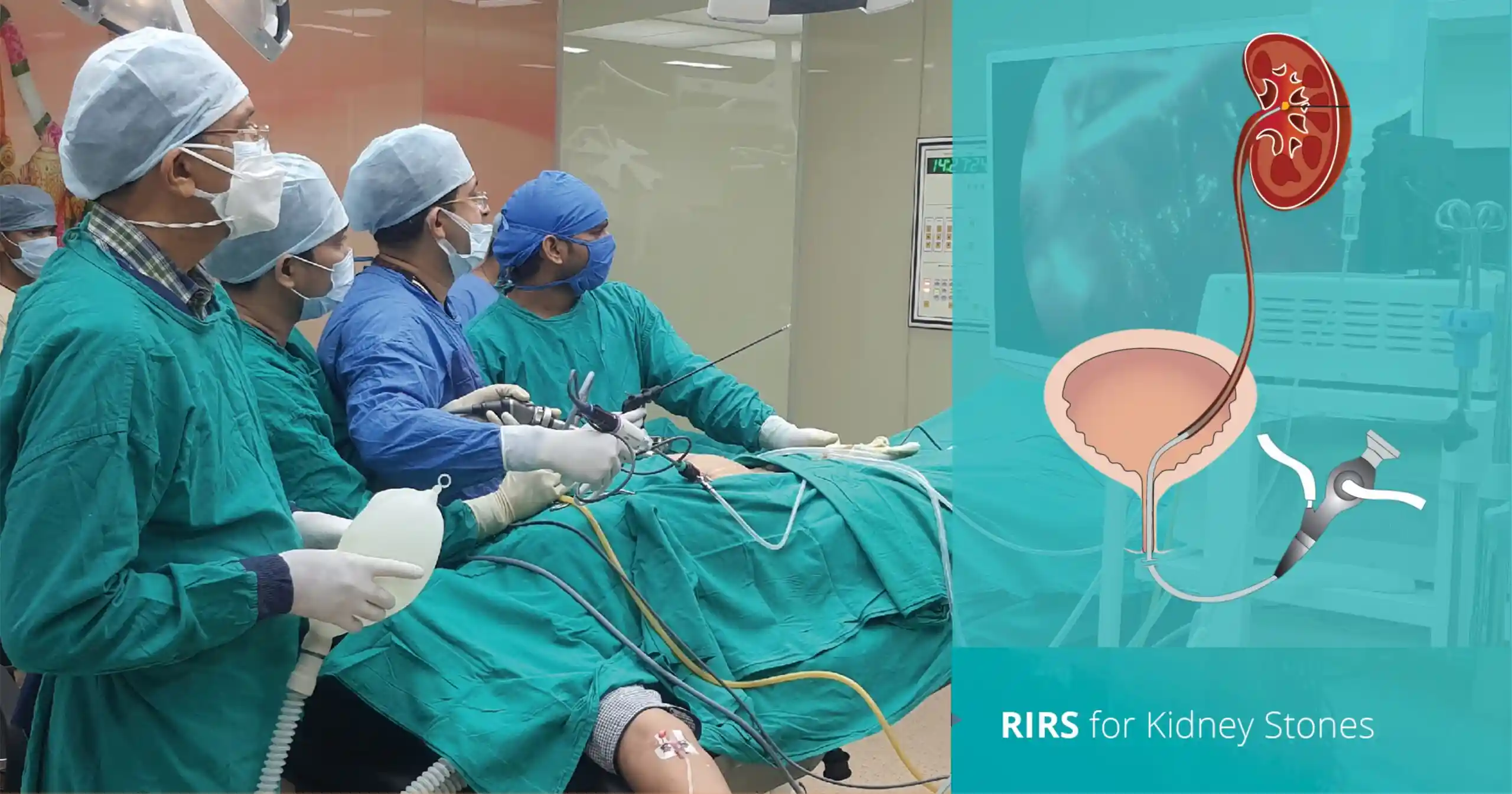 Pakistan Achieves First-Ever Scar-Free Kidney Stone Surgery Using Advanced RIRS