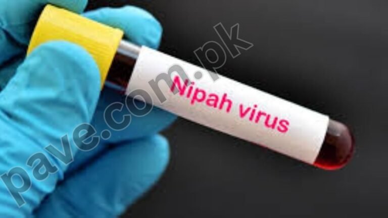 What Are Nipah Virus Symptoms and Treatment Revealed